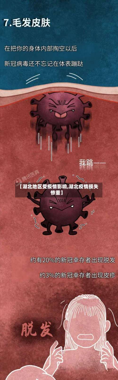 【湖北地区受疫情影响,湖北疫情损失惨重】-第2张图片